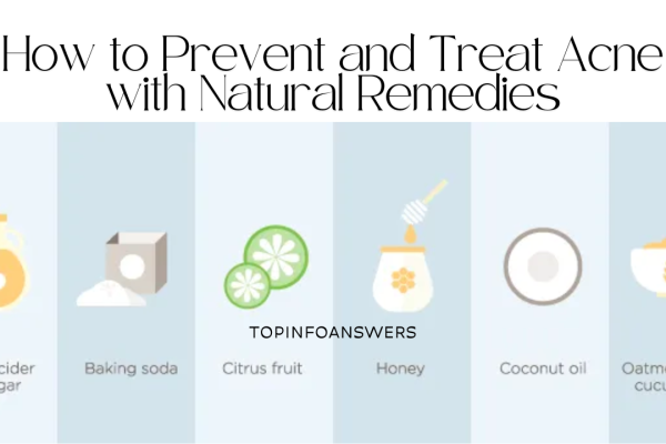 How to Prevent and Treat Acne with Natural Remedies