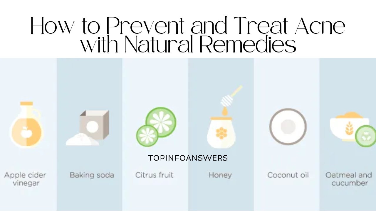 How to Prevent and Treat Acne with Natural Remedies